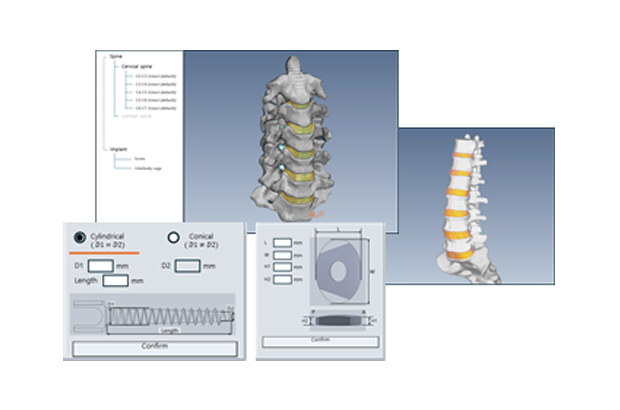 Digital Spine Testing System